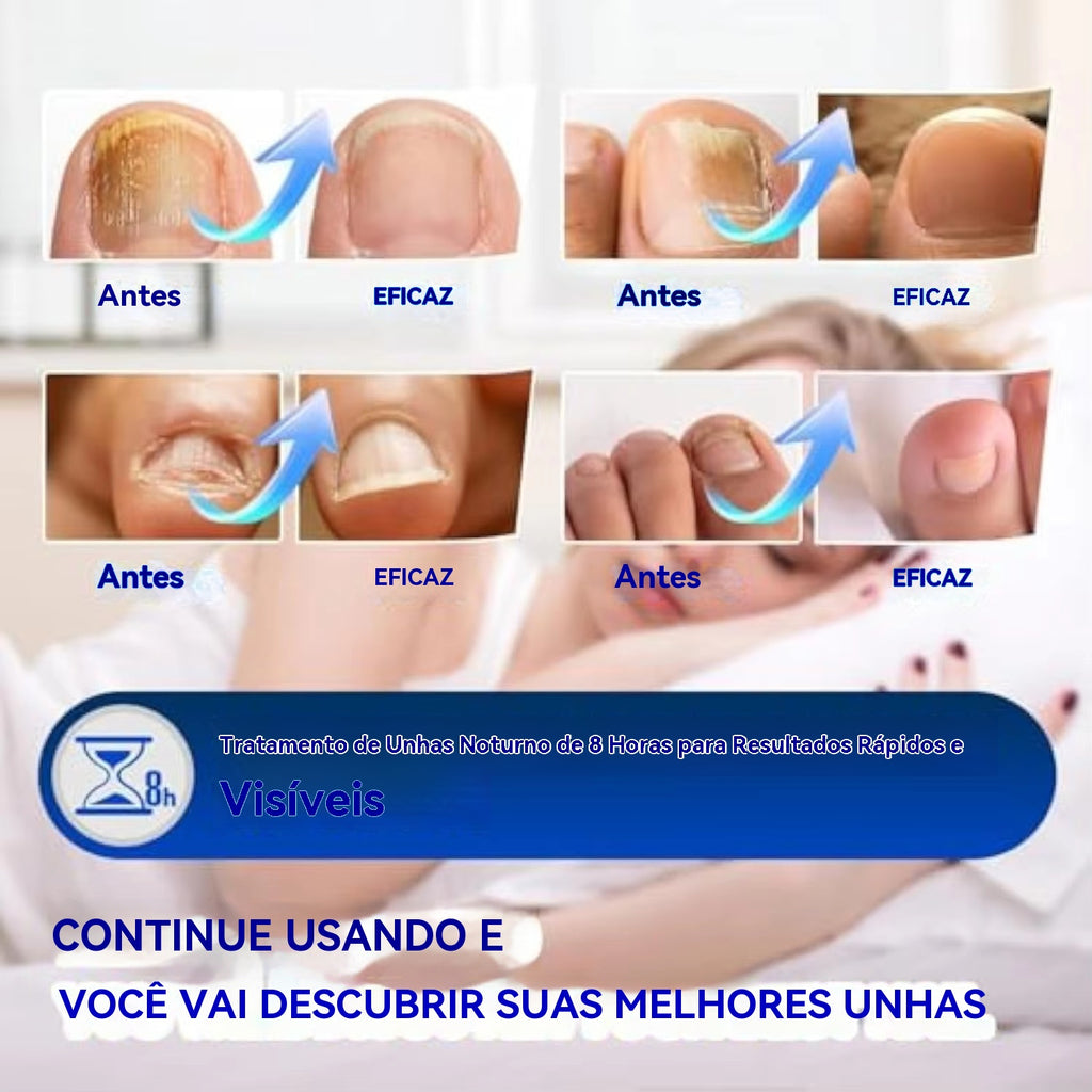 Reparação noturna de 8 horas para manchas de fungos nas unhas.