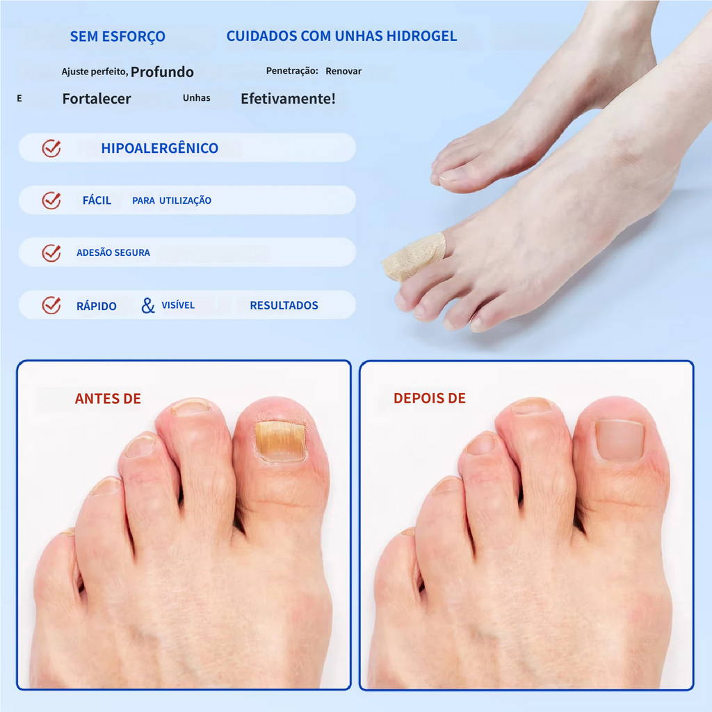 Reparação noturna de 8 horas para manchas de fungos nas unhas.